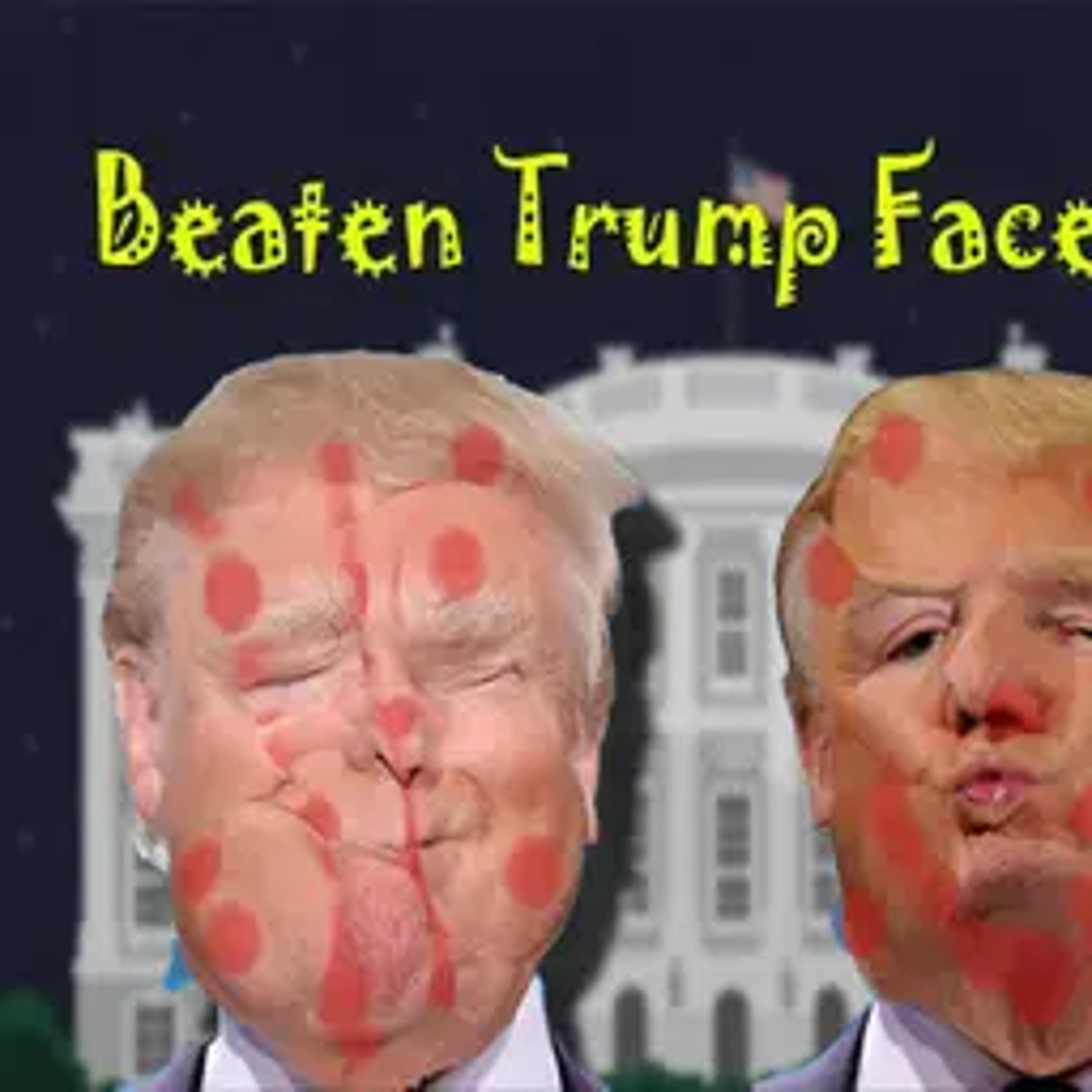 Beaten Trump Face LOL